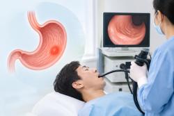 위암 국가검진 40세부터…대상 여부는 공단서 확인
