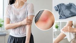 “젖은 옷 오래 입으면 왜 쓸릴까?”…습기와 피부 마찰의 관계